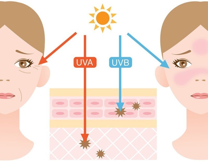  Điều trị nám da hiệu quả với Dr. Hoàng Mạnh Kha