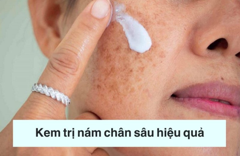  NGUYÊN NHÂN VÀ GIẢI PHÁP TRỊ NÁM HIỆU QUẢ