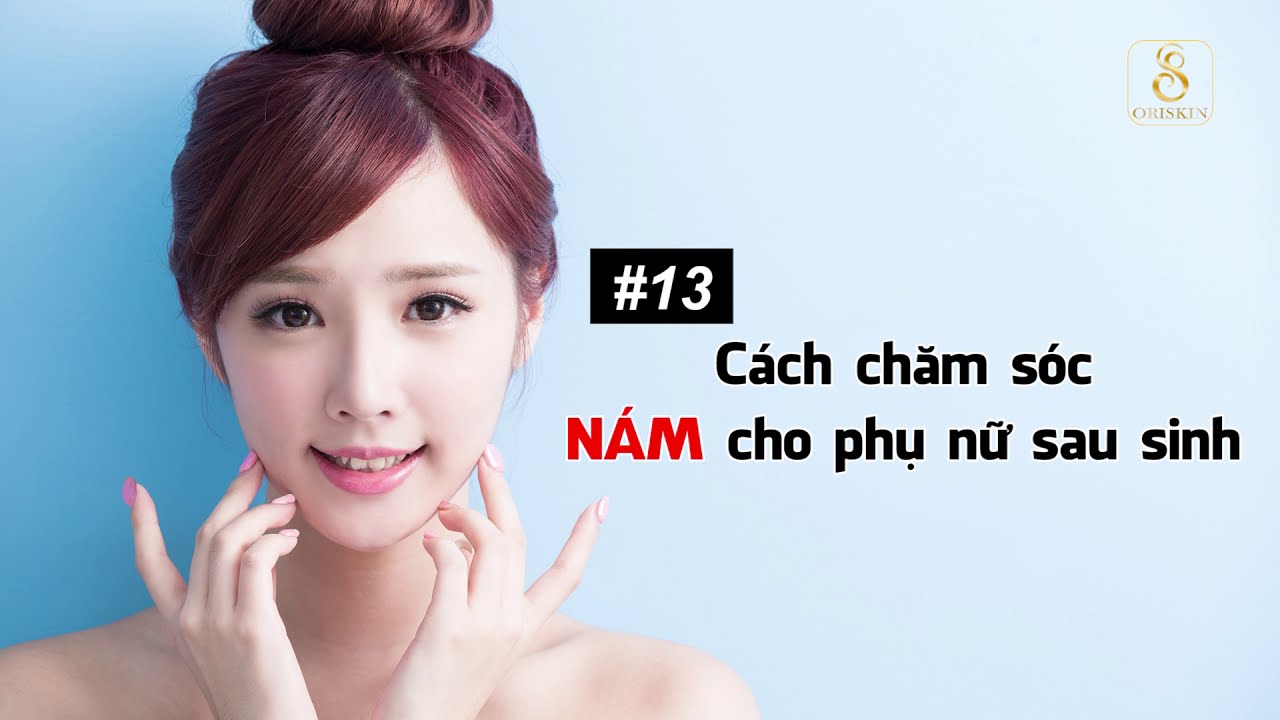 Bị Nám Khi Mang Thai Sinh Xong Có Hết Không?