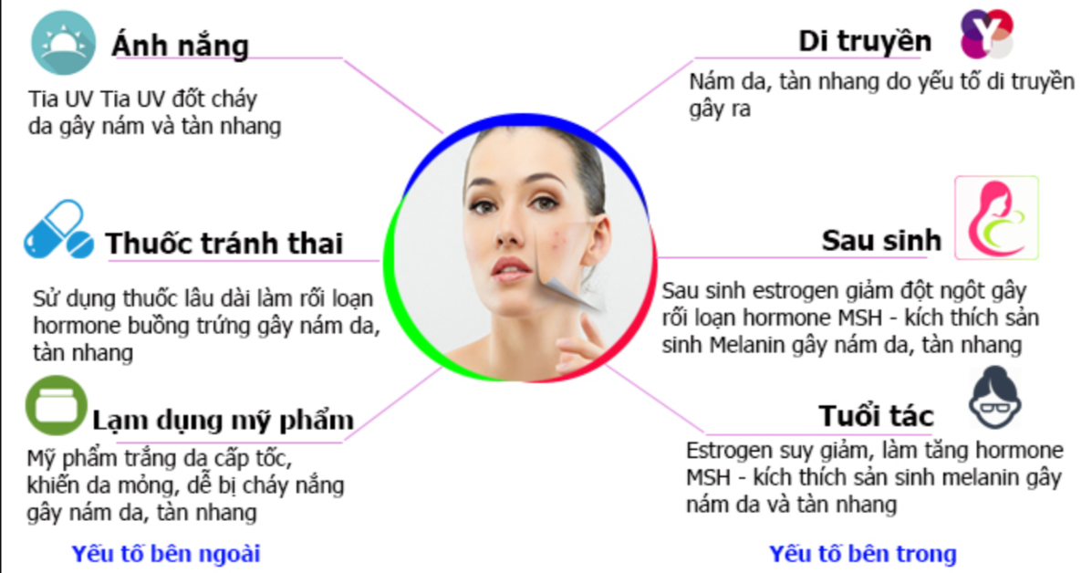 Nám da nguyên nhân và cách điều trị