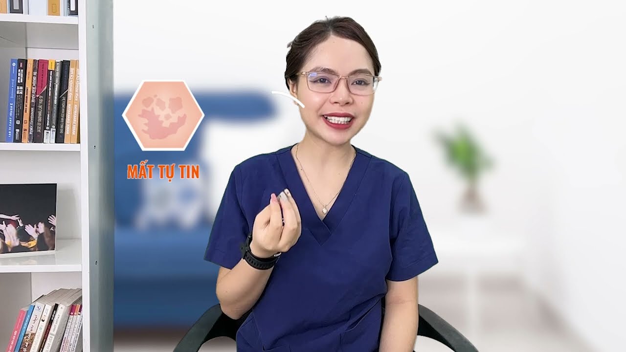 Nám mảng có dễ chữa không?